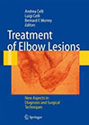 treatment-of-elbow
