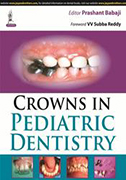 crowns-in-pediatric-dentistry