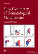 flow-cytometry-of-hematological-malignancies
