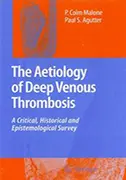 aetiology-of-deep-venous-thrombosis