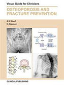 osteoporosis-and-fracture-risk