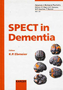 spect-in-dementia