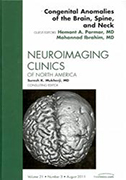 congenital-abnormalities-of-the-brain