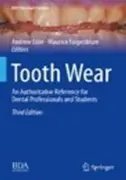 tooth-wear