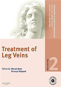 treatment-of-leg-veins