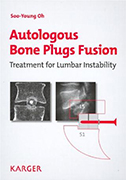 autologous-bone-plugs-fusion