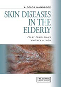 skin-diseases-in-the-elderly