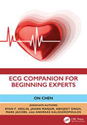 ecg-companion-for-beginning-experts