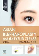 asian-blepharoplasty