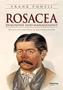 rosacea-disease-and-management