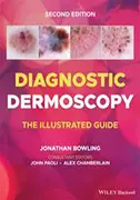 diagnostic-dermoscopy