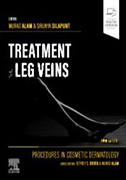 treatment-of-leg-veins