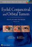 atlas-of-eyelid