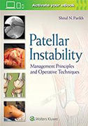 patellar-instability