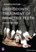 orthodontic-treatmen-of-impacted-teeth.