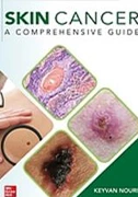 skin-cancer-a-comprehensive-guide