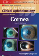 cornea