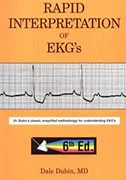 rapid-interpretation-of-ekgs