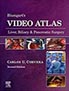 blumgarts-video-atlas-liver-books