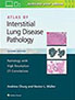 atlas-of-interstitial-lung-disease-pathology-books