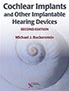 cochlear-implants-books