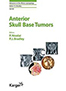 anterior-skull-base-tumors-books