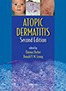 atopic-dermatitis-books